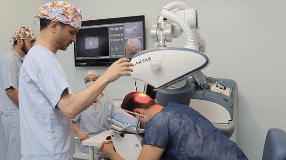 haarimplantate