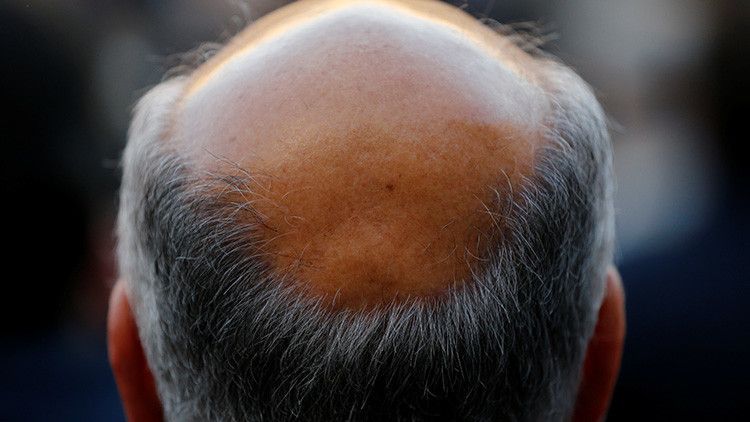 Anti-Haar Shampoo