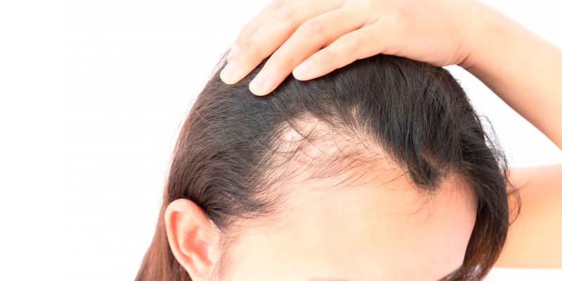 Lösung gegen Haarausfall