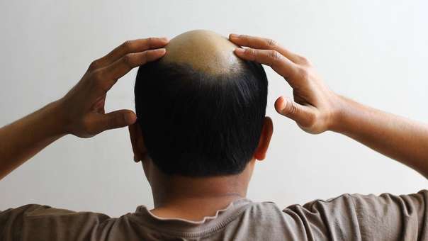 verlorenes haar wiederherstellen