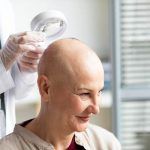 Haarausfall durch Chemotherapie