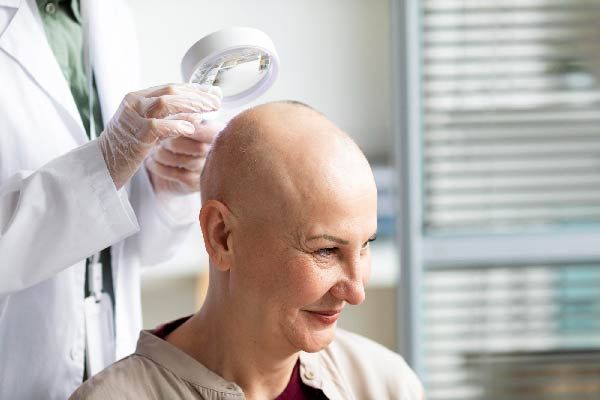 Haarausfall durch Chemotherapie