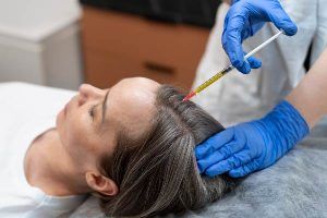 Haartransplantation ohne Rasur