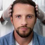 Nachsorge nach einer Haartransplantation