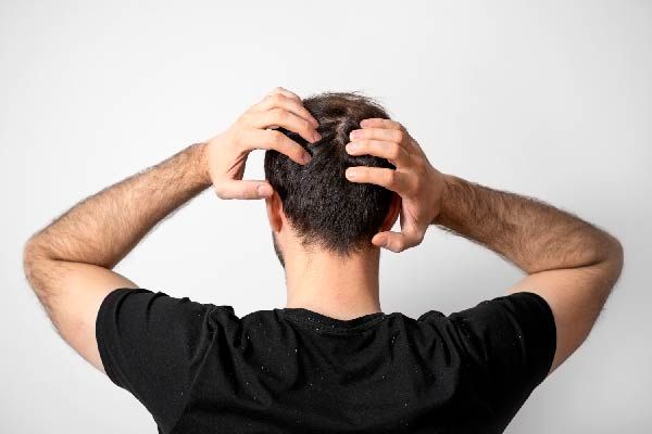 häufigsten Haarprobleme