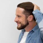 Haartransplantation kosten Türkei