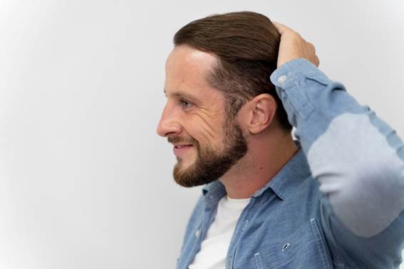 Haartransplantation kosten Türkei