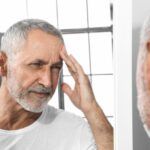 Mann schaut mit besorgtem und traurigem Gesichtsausdruck wegen seiner Alopezie in den Spiegel - Psychologischen konsequenzen alopezie haartransplantation